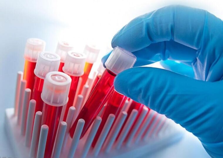 blood tests for osteochondrosis