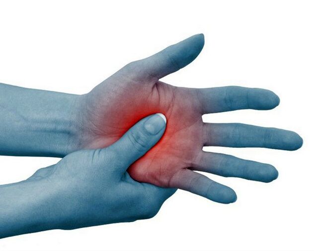 Severe pain in the finger joints, relieved by exercise, is a typical sign of rheumatoid arthritis. 